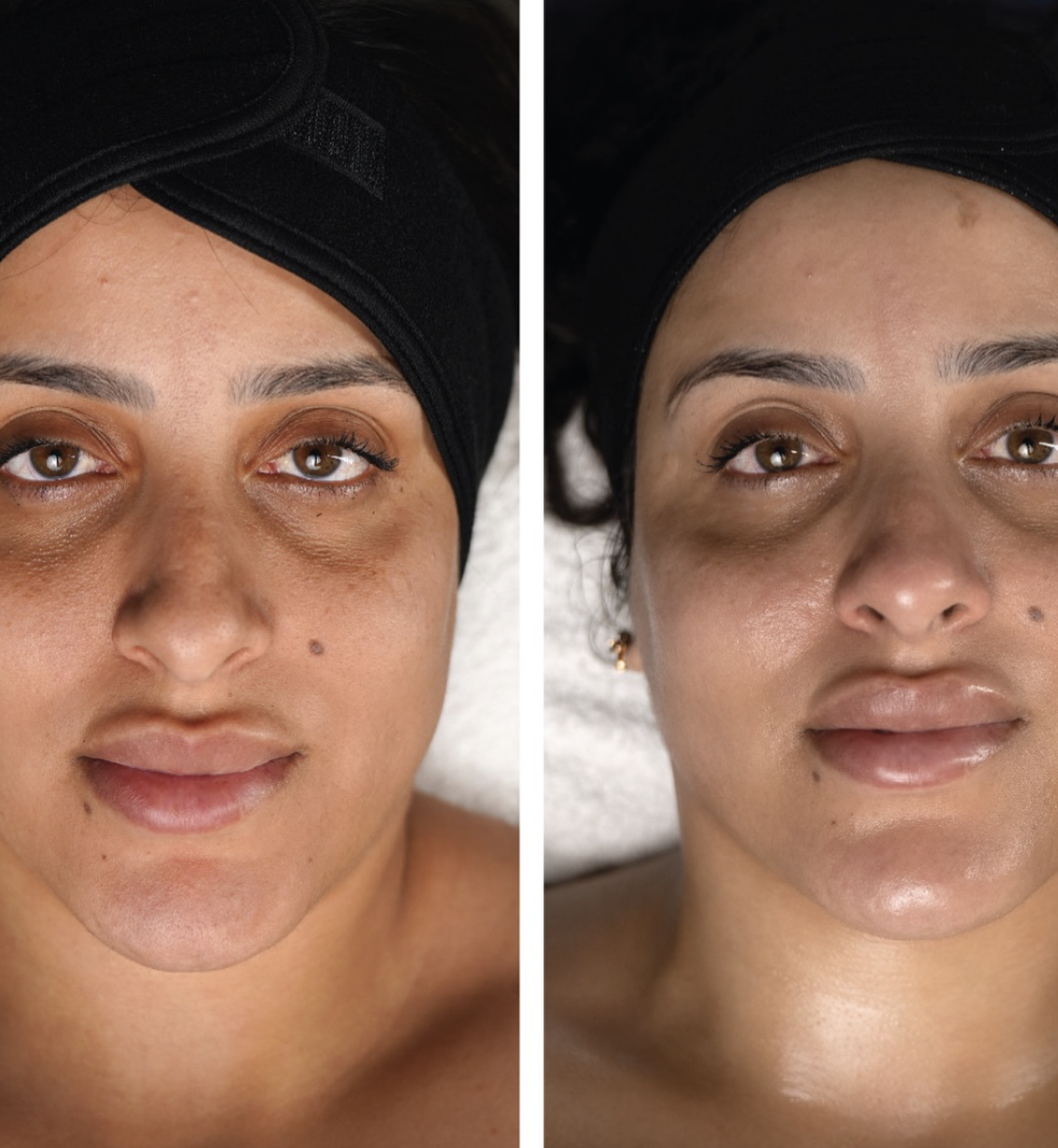 Refreshed, balanced-looking skin result