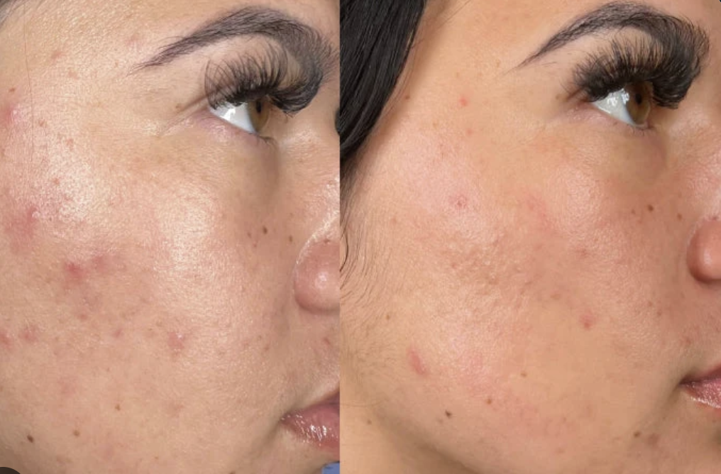 Hydrating serum application close-up