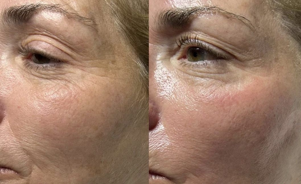 Glowing finished skin result