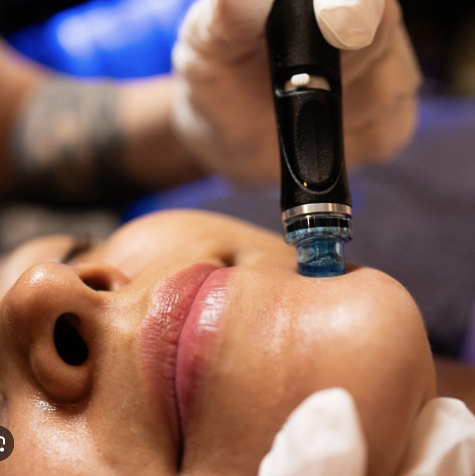 HydraFacial treatment device being used at Lioréa Lounge