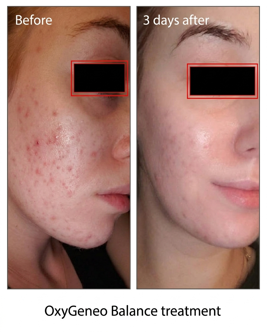 Refreshed, glowing skin result